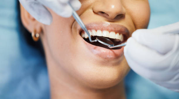 Best Emergency Cosmetic Dentistry (e.g., broken veneers) in Obion, TN